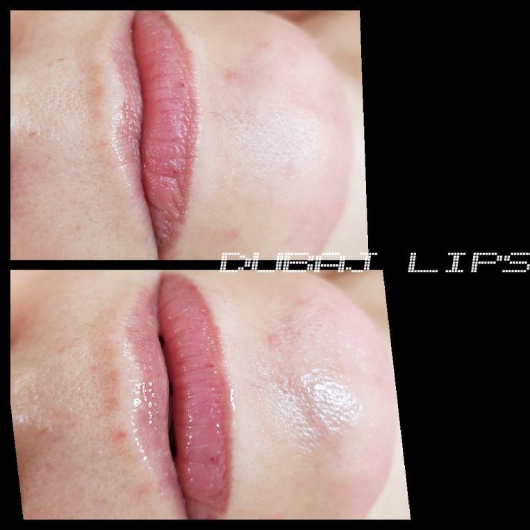 dubaj lips 2