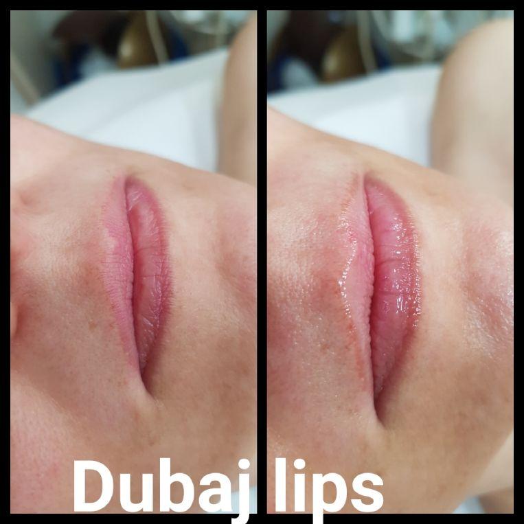 dubaj lips